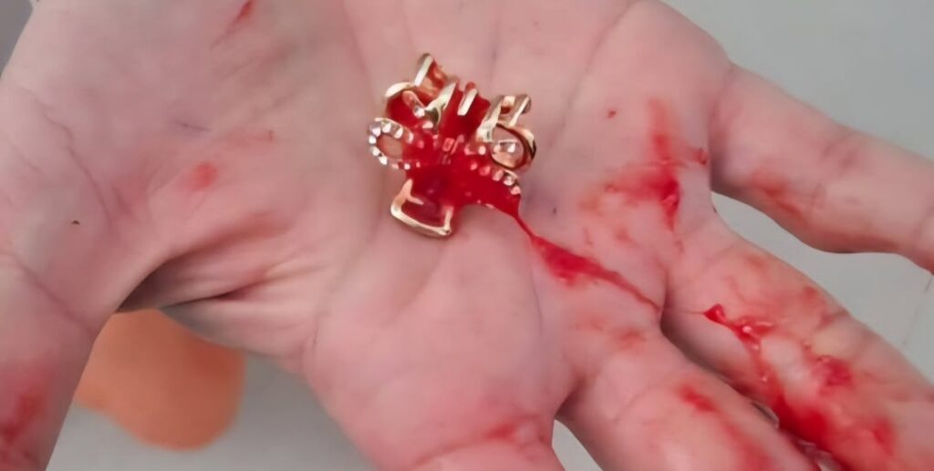 Menino de 2 anos é salvo após se engasgar com prendedor de cabelo